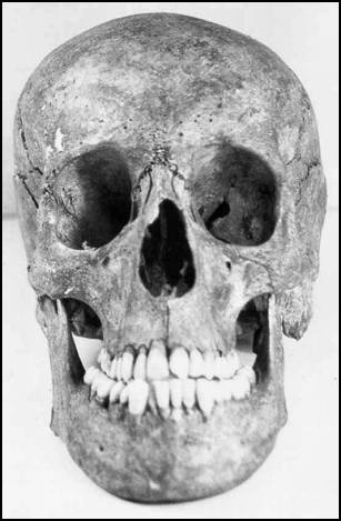 Human skull
